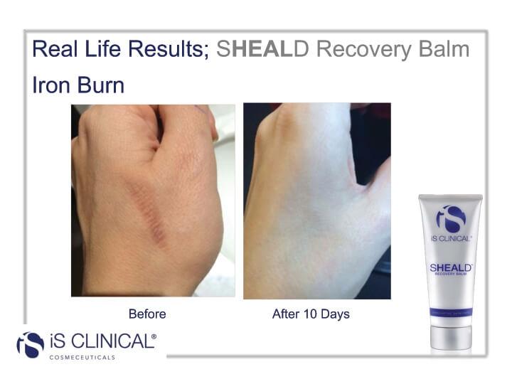 Sheald Recovery Balm