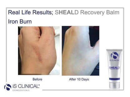 Sheald Recovery Balm