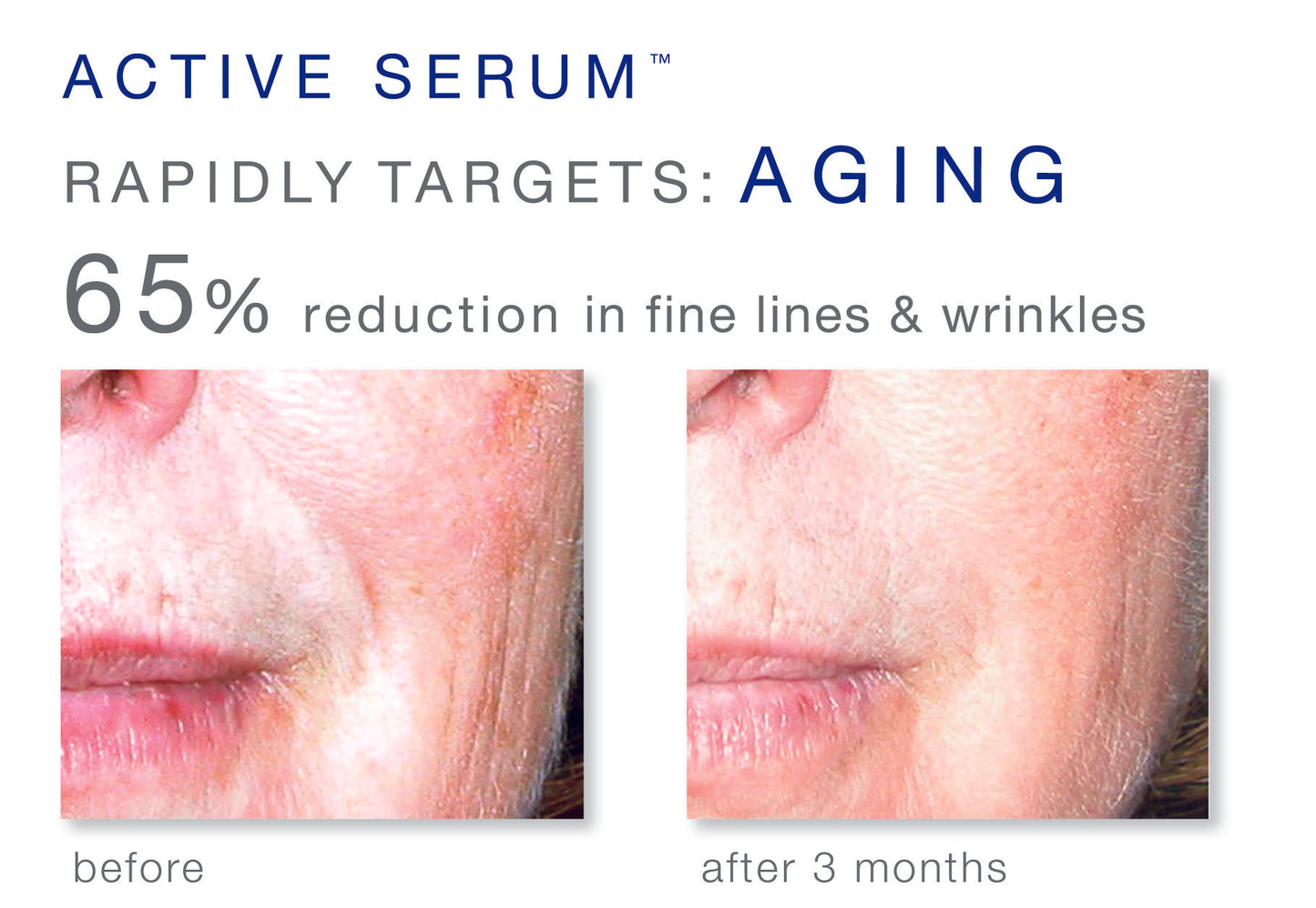 Active Serum